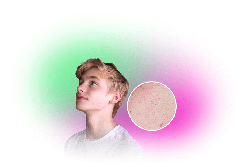 skin