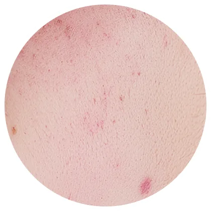 skin